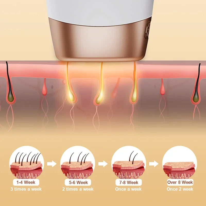 SilkPulse™ – 999,999 Flash IPL Hair Removal System