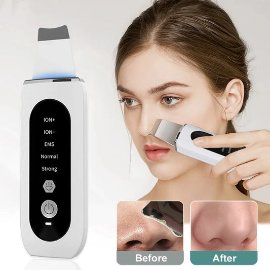 SkinSonic™ – Deep Pore Ultrasonic Cleanser